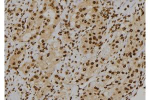 ABIN6277118 at 1/100 staining Human kidney tissue by IHC-P. (Cullin 1 抗体)