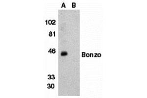Western Blotting (WB) image for anti-Chemokine (C-X-C Motif) Receptor 6 (CXCR6) (N-Term) antibody (ABIN1031691) (CXCR6 抗体  (N-Term))