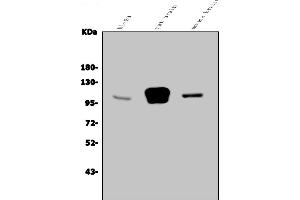 Western blot analysis of GRID2 using anti-GRID2 antibody (ABIN7602349).