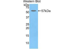 Western blot analysis of the recombinant protein. (GBA 抗体  (AA 248-508))