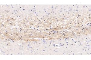 Detection of CDNF in Rat Cerebrum Tissue using Monoclonal Antibody to Cerebral Dopamine Neurotrophic Factor (CDNF) (CDNF 抗体  (AA 20-183))