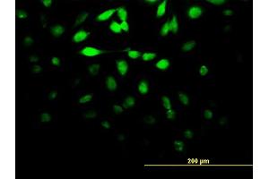 Immunofluorescence of monoclonal antibody to DUSP5 on HeLa cell. (DUSP5 抗体  (AA 286-384))