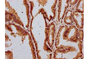 IHC image of ABIN7149497 diluted at 1:400 and staining in paraffin-embedded human prostate tissue performed on a Leica BondTM system. (DAZAP2 抗体  (AA 1-168))