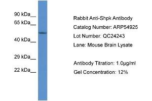 Western Blotting (WB) image for anti-Sedoheptulokinase (SHPK) (Middle Region) antibody (ABIN2785956) (SHPK 抗体  (Middle Region))