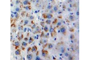 IHC-P analysis of Liver tissue, with DAB staining. (OLR1 抗体  (AA 81-273))