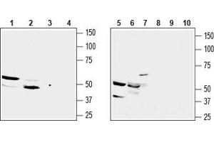 Western blot analysis of rat kidney membrane (lanes 1 and 3), mouse kidney lysate (lanes 2 and 4), mouse TK-1 T-cell lymphoma (lanes 5 and 8), mouse J774 macrophage cell (lanes 6 and 9) and human Jurkat acute T cell leukemia (lanes 7 and 10) lysates: - 1,2,5,6,7. (SUCNR1 抗体  (3rd Extracellular Loop))