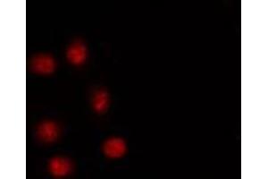 ABIN6267249 staining HT29 by IF/ICC. (SNAIL 抗体  (pSer246))