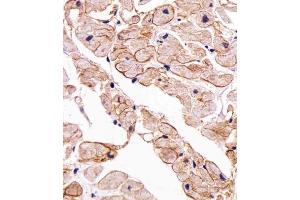 Immunohistochemical analysis of paraffin-embedded H. (SGCG 抗体  (AA 145-172))