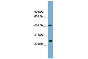 FLJ25439 antibody used at 1 ug/ml to detect target protein. (TTC23L 抗体  (N-Term))