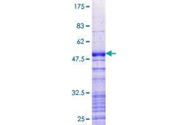 SFRS12IP1 Protein (AA 1-155) (GST tag)