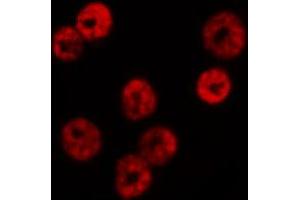 ABIN6267660 staining HeLa by IF/ICC. (SMAD1 抗体  (pSer465))