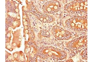 IHC image of ABIN7171957 diluted at 1:1200 and staining in paraffin-embedded human small intestine tissue performed on a Leica BondTM system. (TGFBR1 抗体  (AA 157-244))