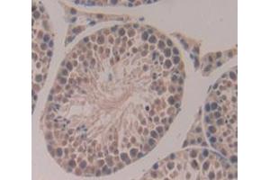 Used in DAB staining on fromalin fixed paraffin- embedded Kidney tissue (Aurora Kinase C 抗体  (AA 5-237))