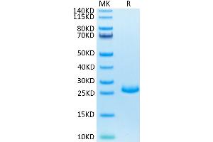 Fibroblast Growth Factor 21 (FGF21) (AA 29-210) protein (His tag)