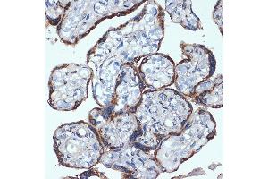 Immunohistochemistry of paraffin-embedded human placenta using P4HB Rabbit mAb (ABIN7269560) at dilution of 1:100 (40x lens). (P4HB 抗体)