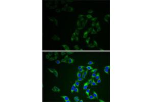 Immunofluorescence (IF) image for anti-Adenylate Kinase 1 (AK1) (AA 1-194) antibody (ABIN3021756)