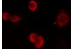 ABIN6274180 staining HuvEc cells by IF/ICC. (ZNF24 抗体  (Internal Region))