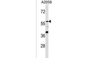 ZN Antibody (N-term) (ABIN1539362 and ABIN2849856) western blot analysis in  cell line lysates (35 μg/lane). (ZNF776 抗体  (N-Term))