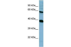 Western Blotting (WB) image for anti-Protein Phosphatase 2, Regulatory Subunit A, alpha (PPP2R1A) (N-Term) antibody (ABIN2787389) (PPP2R1A 抗体  (N-Term))