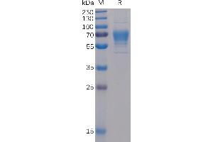 TNFSF8 Protein (mFc-His Tag)