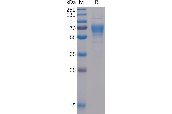 TNFSF8 Protein (mFc-His Tag)