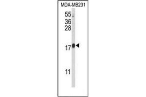Western blot analysis of CBY1 Antibody (C-term) in MDA-MB231 cell line lysates (35ug/lane). (CBY1/PGEA1 抗体  (C-Term))