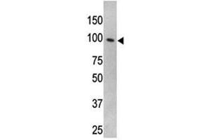 TLR5 antibody used in western blot to detect TLR5 in HL-60 cell lysate (TLR5 抗体  (AA 71-102))