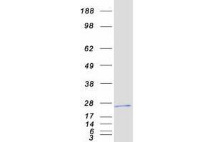 Western Blotting (WB) image for Phospholipase A2, Group IIA (Platelets, Synovial Fluid) (PLA2G2A) protein (Myc-DYKDDDDK Tag) (ABIN2729075)
