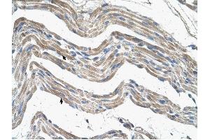 IDH3A antibody was used for immunohistochemistry at a concentration of 4-8 ug/ml to stain Skeletal muscle cells (arrows) in Human Muscle. (IDH3A 抗体)