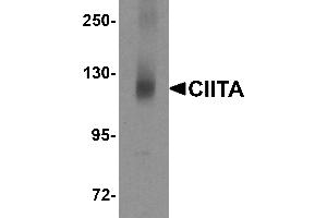 Western Blotting (WB) image for anti-Class II, Major Histocompatibility Complex, Transactivator (CIITA) (N-Term) antibody (ABIN1031320) (CIITA 抗体  (N-Term))
