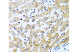 Immunohistochemistry of paraffin-embedded Human liver using CCL21 Polyclonal Antibody at dilution of 1:100 (40x lens). (CCL21 抗体)