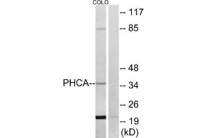 Western blot analysis of extracts from COLO cells, using PHCA antibody. (ACER3 抗体  (Internal Region))