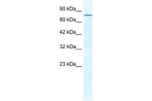 Western Blotting (WB) image for anti-DEAD (Asp-Glu-Ala-Asp) Box Polypeptide 23 (DDX23) antibody (ABIN2461345) (DDX23 抗体)