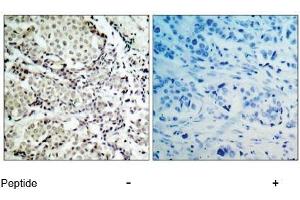 Image no. 1 for anti-Mitogen-Activated Protein Kinase Kinase 3 (MAP2K3) (Ser189) antibody (ABIN197296)