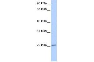TCEAL2 antibody used at 0. (TCEAL2 抗体  (N-Term))