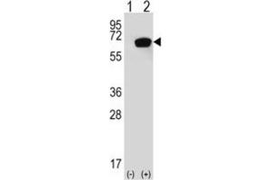 Western Blotting (WB) image for anti-Heat Shock 70kDa Protein 1A (HSPA1A) antibody (ABIN3003299) (HSP70 1A 抗体)
