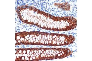 Immunohistochemistry of paraffin-embedded human appendix using Galectin 4/LG Rabbit mAb (ABIN1679347, ABIN3017979, ABIN3017980 and ABIN7101554) at dilution of 1:100 (40x lens). (GAL4 抗体)