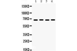 Western Blotting (WB) image for anti-Ets Variant 4 (ETV4) (AA 1-41), (N-Term) antibody (ABIN3042379) (ETV4 抗体  (N-Term))