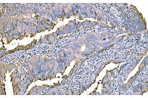 IHC analysis of Prothrombin using anti-Prothrombin antibody (ABIN7602705). (Prothrombin Fragment 2 (AA 97-124) 抗体)