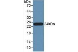 Detection of Recombinant PTa, Human using Polyclonal Antibody to Pancreas Specific Transcription Factor 1a (PTF1a) (PTF1A 抗体  (AA 177-328))
