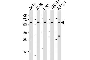 All lanes : Anti-PICALM Antibody (Center) at 1:2000 dilution Lane 1: A431 whole cell lysates Lane 2: A549 whole cell lysates Lane 3: Hela whole cell lysates Lane 4: NIH/3T3 whole cell lysates Lane 5: rat brain lysates Lysates/proteins at 20 μg per lane. (PICALM 抗体  (AA 385-415))