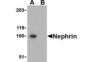 Western blot analysis of Nephrin in mouse kidney tissue lysate with Nephrin antibody at 1 µg/mL in the (A) absence and (B) presence of blocking peptide. (Nephrin 抗体  (C-Term))