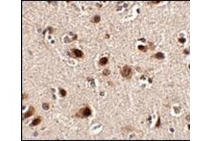 Immunohistochemistry of Slitrk4 in human brain tissue with this product at 2. (SLITRK5 抗体  (Center))
