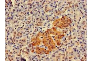 Immunohistochemistry of paraffin-embedded human pancreatic tissue using ABIN7173936 at dilution of 1:100 (TWF1 抗体  (AA 199-252))