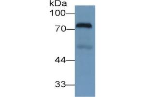 Rabbit Detection antibody from the kit in WB with Positive Control: Sample Human Lung lysate.