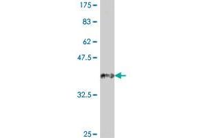 Western Blot detection against Immunogen (37. (SFRP4 抗体  (AA 211-312))