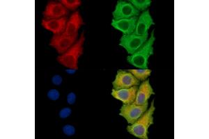 ABIN7094925 and ABIN7098981 staining Hela cells by IF/ICC.