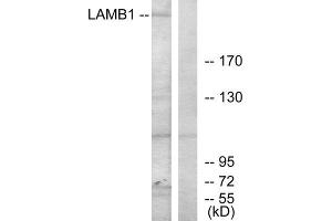 Western Blotting (WB) image for anti-Laminin, beta 1 (LAMB1) (C-Term) antibody (ABIN1850452) (Laminin beta 1 抗体  (C-Term))