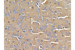 ABIN6258654 and ABIN6275038 at 1/100 staining rat brain tissue by IHC-P. (CNTN2 抗体  (N-Term))