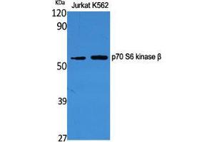Western Blot (WB) analysis of specific cells using p70 S6 kinase beta Polyclonal Antibody. (RPS6KB2 抗体  (Tyr1016))